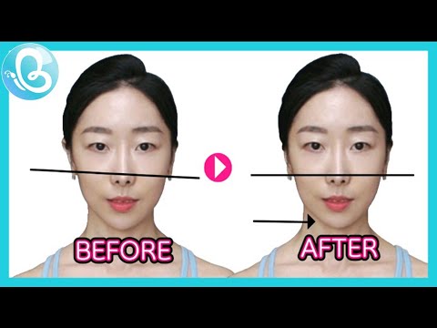 Facial Asymmetry Exercises. - Youtube